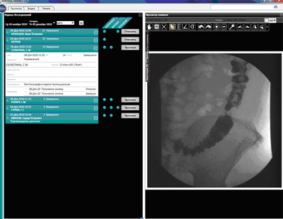 Комплекс для цифровой рентгенографии на основе фотостимулируемых экранов "Оптискан-"Амико" 
