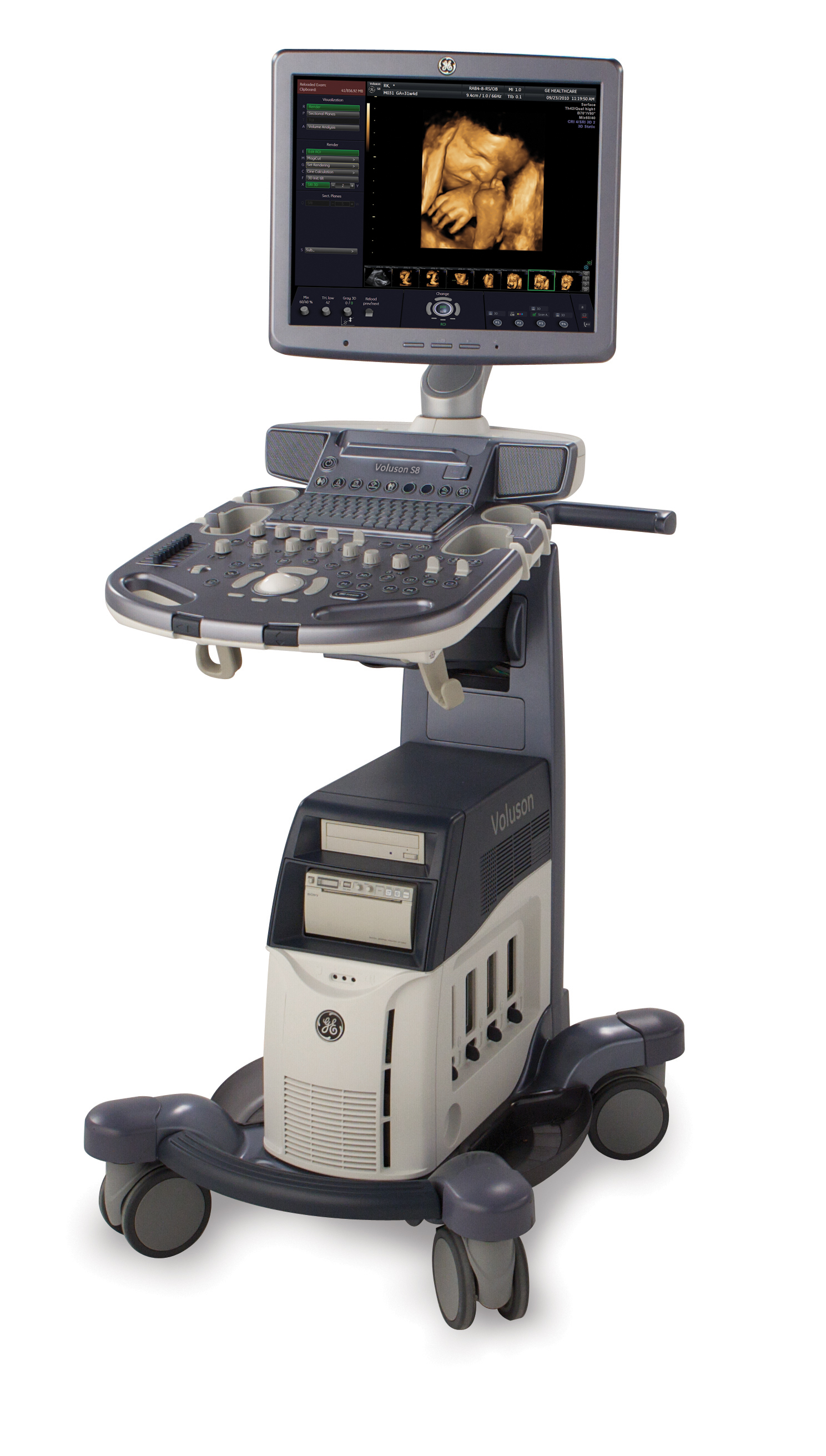 Ультразвуковой сканер Voluson S8